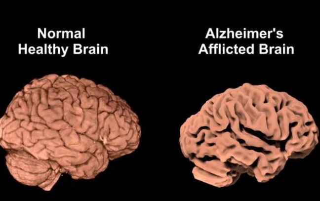 全球首创!! 墨尔本将创造医学奇迹!! 不用打针吃药手术, 轻轻一喷就能逆转绝症-华闻时空